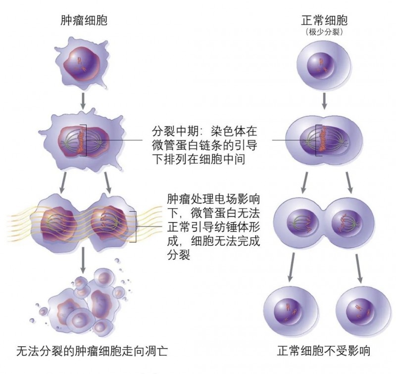 电场疗法是怎么杀死癌细胞的