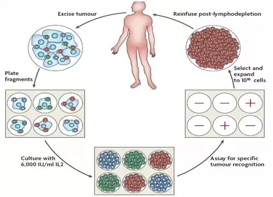TILs疗法的治疗过程