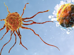 脑瘤疫苗,新型肿瘤DC疫苗AV-GBM-1让脑胶质母细胞瘤患者曙光重现
