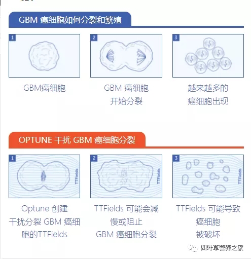 电场治疗的原理