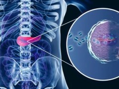 胰腺癌新药,FDA授予SM-88和Zenocutuzumab(MCLA-128)胰腺癌孤儿药地位