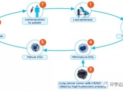 树突细胞疗法联合化疗一线治疗晚期非小细胞肺癌总缓解率大幅提升