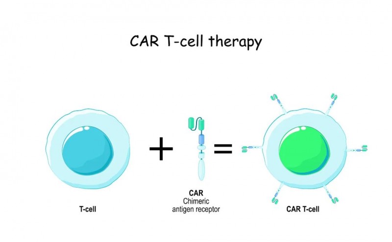 CAR-T细胞疗法