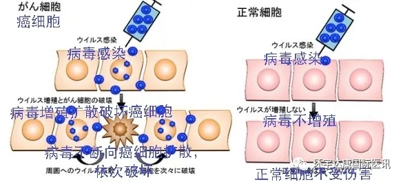 第三代改良的溶瘤病毒