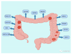 结直肠癌新药、新疗法、新技术