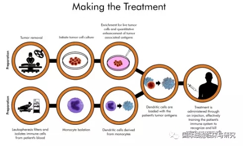 树突细胞疫苗的原理