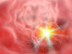 光免疫治疗癌症肿瘤4名复发性性患者肿瘤消失