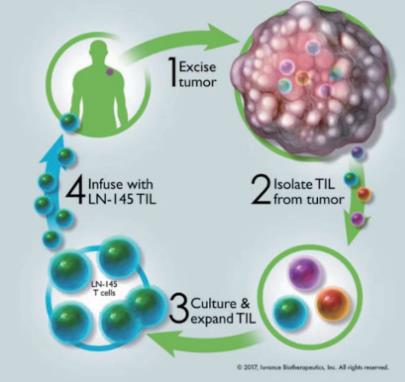 TIL免疫细胞疗法